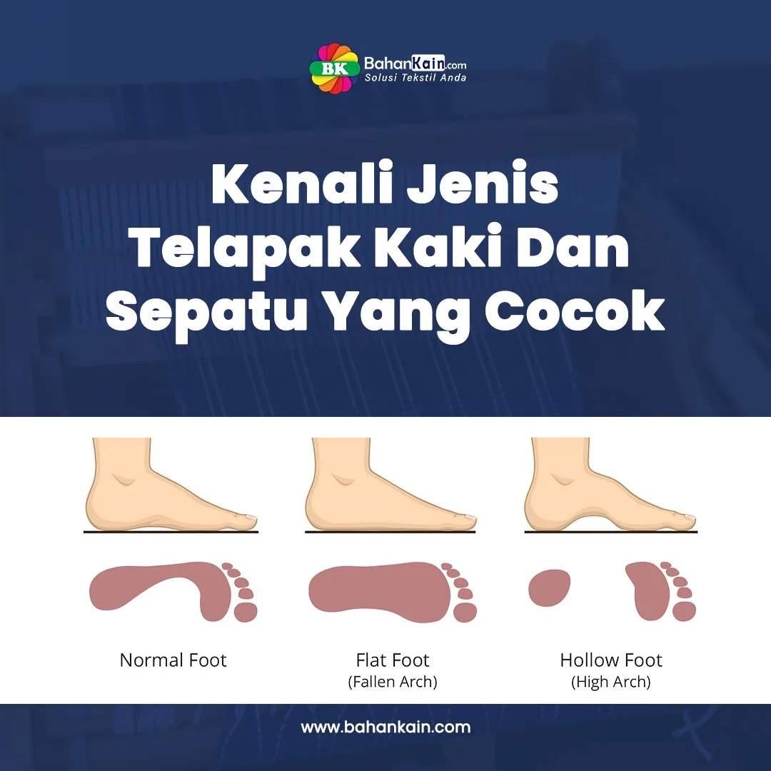 Tips Memilih Sepatu Sesuai Jenis Telapak Kaki